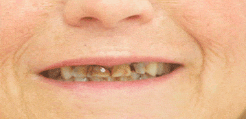 estetica dental torremolinos