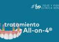 La técnica All-On-4® es un tratamiento revolucionario diseñado para pacientes que han perdido todos los dientes de una arcada (superior o inferior) o presentan una dentición muy deteriorada.