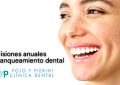 revision y blanqueo dental