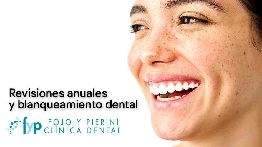 Revisiones anuales y blanqueamiento dental: La clave para una sonrisa perfecta a un coste moderado