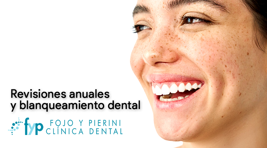 revision y blanqueo dental